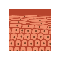 Healthcare webinar by Dermatopathology for Dermatopathology Webinar | Oral Leukoplakia: Are They All Dysplastic in the Molecular Age?